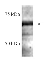 NB300-1065 - Estrogen receptor alpha