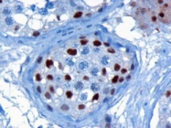 NB100-1374 - KPNA4 / Importin alpha-4