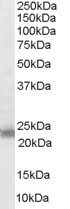 NB600-507 - Transgelin (TAGLN)