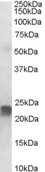 NB600-507 - Transgelin (TAGLN)