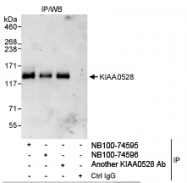 NB100-74595 - KIAA0528