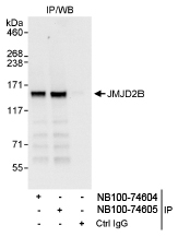 NB100-74604 - JMJD2B / KDM4B
