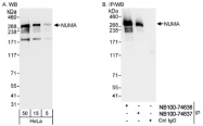 NB100-74636 - NuMA
