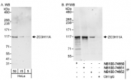 NB100-74650 - ZC3H11A
