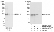 NB100-74651 - ZC3H11A