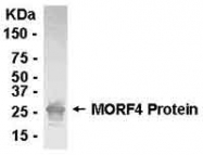 NB100-75513 - MORF4