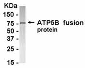 NB100-75604 - ATP synthase subunit beta