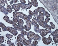 NB100-901IHC - HIF1A / HIF1 alpha