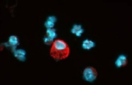 NB100-901IHC - HIF1A / HIF1 alpha