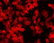 NB100-901IHC - HIF1A / HIF1 alpha