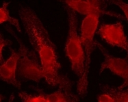 NB100-901IHC - HIF1A / HIF1 alpha
