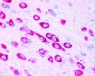 NB100-901IHC - HIF1A / HIF1 alpha