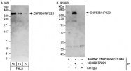 NB100-77291 - ZNF638