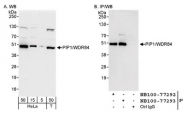 NB100-77293 - WDR84 / PIP1