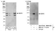 NB100-77296 - WDR3