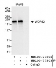 NB100-77302 - WDR62
