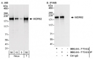 NB100-77303 - WDR62