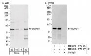 NB100-77307 - WDR91