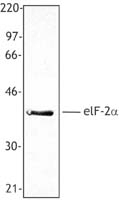 NB100-78297 - EIF2A