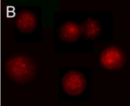 NB100-78531 - Aurora kinase A