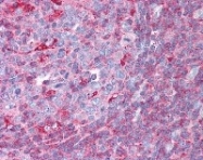 NB100-78537 - RXR-alpha / RXRA