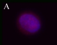 NB100-78564 - Tuberin / TSC2
