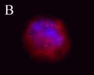 NB100-78564 - Tuberin / TSC2