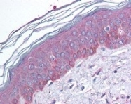 NB100-78564 - Tuberin / TSC2