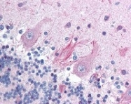 NB100-78571 - RPS6KA1
