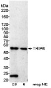 NB100-79791 - TRIP6 / OIP1