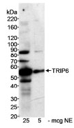 NB100-79792 - TRIP6 / OIP1