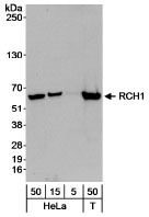 NB100-79807 - KPNA2 / Importin alpha-2