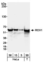 NB100-79808 - KPNA2 / Importin alpha-2