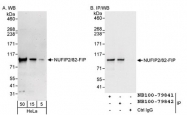 NB100-79841 - NUFIP2