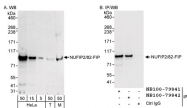 NB100-79842 - NUFIP2