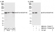 NB100-79848 - SF3B2 / SAP145