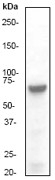 NB100-80027 - EIF2AK2 / PKR
