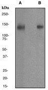 NB100-80061 - TrkA