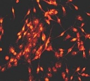 NB100-80061 - TrkA