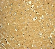 NB100-80061 - TrkA