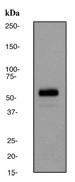 NB100-80063 - Tyrosine 3-monooxygenase (TH)