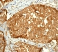 NB100-80067 - YAP1