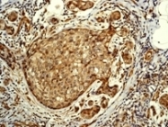 NB100-80068 - YAP1