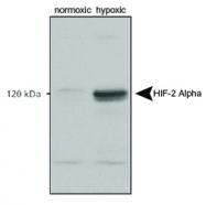 NB100-122B - HIF2A / HIF2 alpha