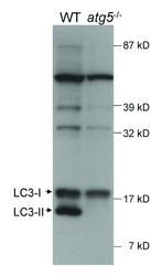 NB100-2331H - LC3B