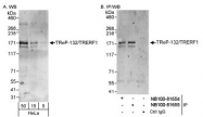 NB100-81655 - TRERF1