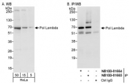 NB100-81664 - DNA polymerase lambda