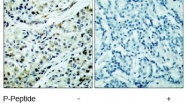 NB100-81953 - HDAC5