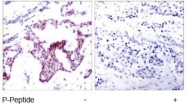 NB100-82086 - RELA / NF-kB p65