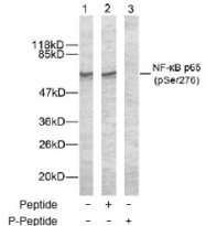 NB100-82086 - RELA / NF-kB p65